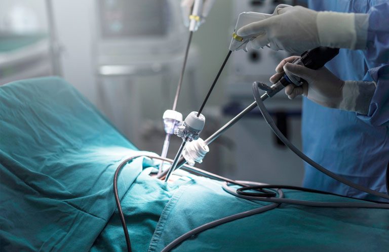 laparoscopy_rsia_gladiool-2